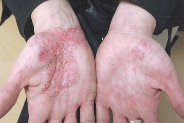 Gluten-Free Skin Care